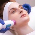 Know Every Important Fact About Thermage